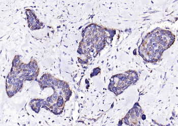 ECM1 Rabbit Polyclonal Antibody