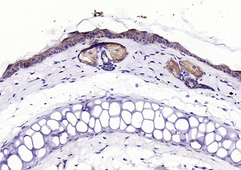 ECM1 Rabbit Polyclonal Antibody