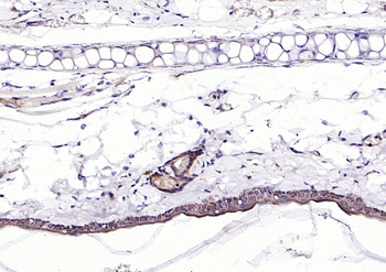 ECM1 Rabbit Polyclonal Antibody
