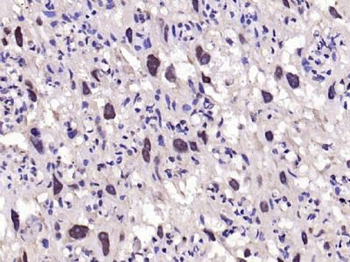 EGFR Rabbit Polyclonal Antibody