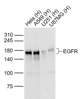 EGFR Rabbit Polyclonal Antibody