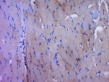 Phospho-EGFR (Tyr1068) Rabbit Polyclonal Antibody