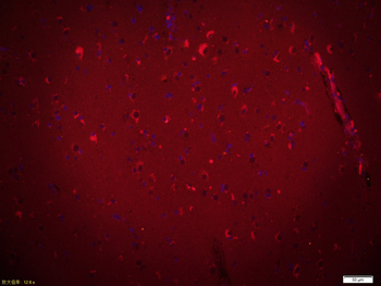 EGFR Rabbit Polyclonal Antibody