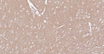VGLUT1/BNP1 Rabbit Polyclonal Antibody
