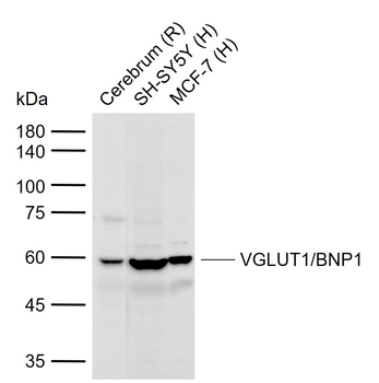 VGLUT1/BNP1 Rabbit Polyclonal Antibody