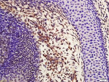 Phospho-Lyn (Tyr507) Rabbit Polyclonal Antibody