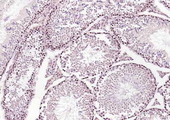 ERCC1 Rabbit Polyclonal Antibody