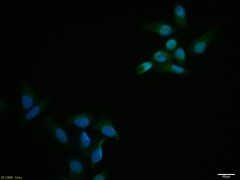 MAPK4 Rabbit Polyclonal Antibody