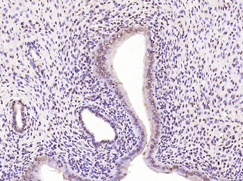 Phospho-IRS1 (Ser1101) Rabbit Polyclonal Antibody