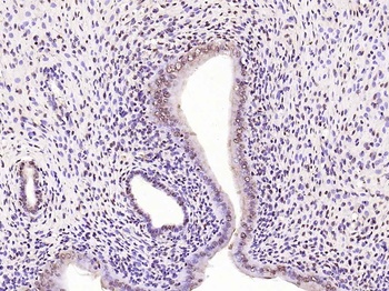 IRS1 (phospho-Ser307) antibody