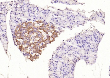 IRS1 (phospho-Ser312) antibody