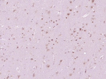 Phospho-Smad3 (Ser213) Rabbit Polyclonal Antibody
