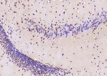 Phospho-Smad3 (Ser213) Rabbit Polyclonal Antibody