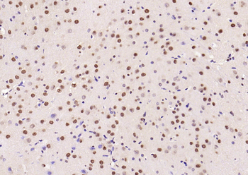 Phospho-Smad3 (Ser213) Rabbit Polyclonal Antibody
