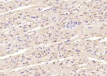 Phospho-Smad3 (Ser213) Rabbit Polyclonal Antibody