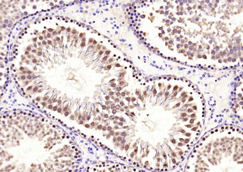 Phospho-Smad3 (Ser213) Rabbit Polyclonal Antibody