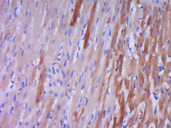Big endothelin-1 Rabbit Polyclonal Antibody