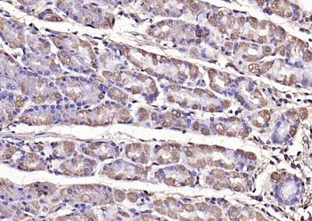 Phospho-FAK (Tyr397) Rabbit Polyclonal Antibody