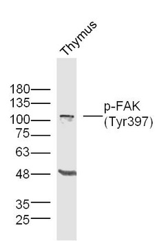 FAK (phospho-Tyr397) antibody