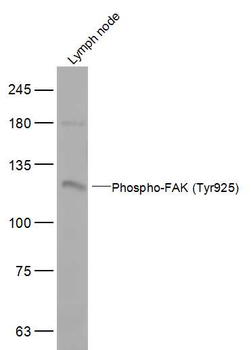 Phospho-FAK (Tyr925) Rabbit Polyclonal Antibody