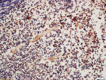 Phospho-FAK (Tyr925) Rabbit Polyclonal Antibody