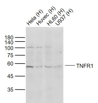 TNFR1 Rabbit Polyclonal Antibody