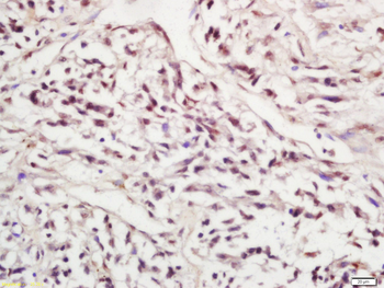 Phospho-SIRT1 (Ser47) Rabbit Polyclonal Antibody