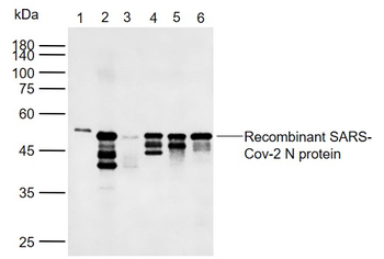SARS-CoV-2 N Rabbit Polyclonal Antibody