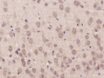 Factor VIII Rabbit Polyclonal Antibody