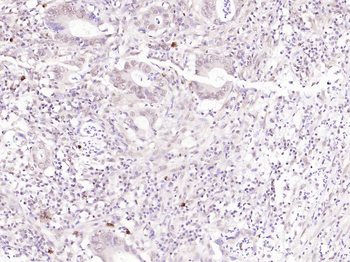 FAK Rabbit Polyclonal Antibody