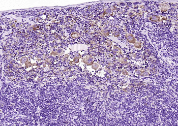 GP1BA Recombinant Rabbit Monoclonal Antibody