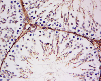 FAF1 Rabbit Polyclonal Antibody