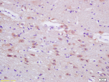 FASN Rabbit Polyclonal Antibody