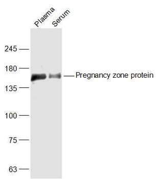 Pregnancy zone protein Rabbit Polyclonal Antibody