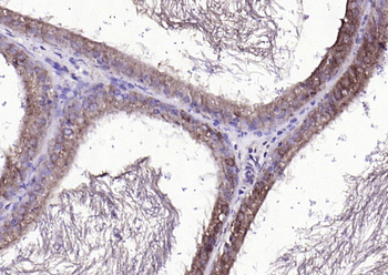 FGF8 Rabbit Polyclonal Antibody