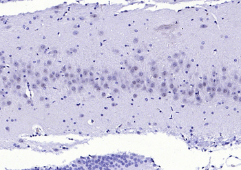 FGFR1 Rabbit Polyclonal Antibody