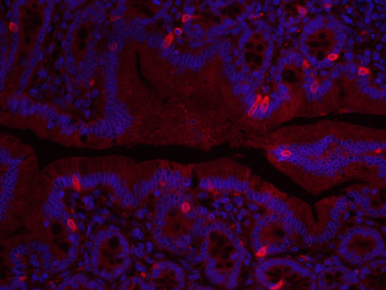 Fibronectin/FN1 Rabbit Polyclonal Antibody