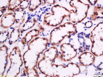 Fibronectin/FN1 Rabbit Polyclonal Antibody
