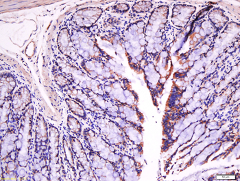 Fibronectin/FN1 Rabbit Polyclonal Antibody