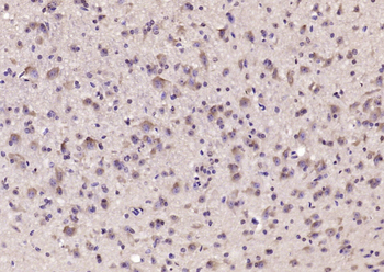 GABRA1/GABA A Receptor alpha 1 Rabbit Polyclonal Antibody