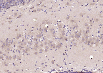 GABRA1/GABA A Receptor alpha 1 Rabbit Polyclonal Antibody