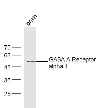 GABRA1/GABA A Receptor alpha 1 Rabbit Polyclonal Antibody