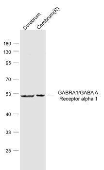GABRA1/GABA A Receptor alpha 1 Rabbit Polyclonal Antibody