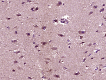 ABCA7 Rabbit Polyclonal Antibody