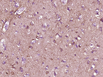 CXCR3 Rabbit Polyclonal Antibody