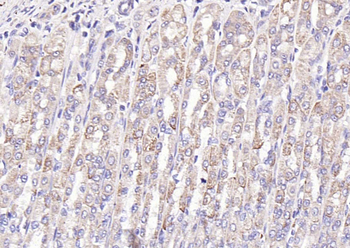 Gastrin Rabbit Polyclonal Antibody