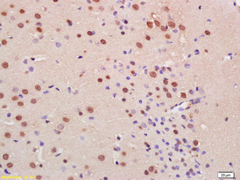C9orf72 Rabbit Polyclonal Antibody