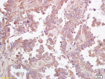 Ceramide glucosyltransferase Rabbit Polyclonal Antibody