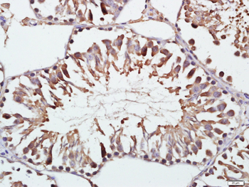 Gelsolin Rabbit Polyclonal Antibody