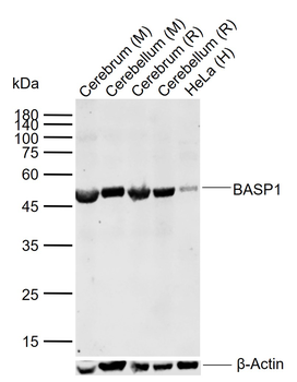 BASP1 Rabbit Polyclonal Antibody